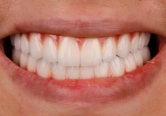 After -The Houston Group