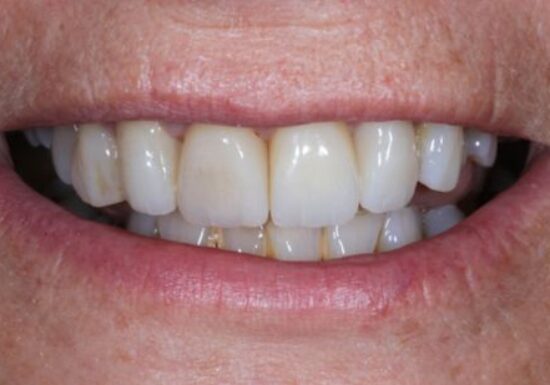 After -The Houston Group