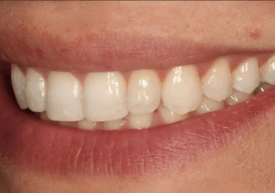 After -The Houston Group