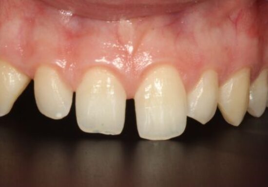 Before - The Houston Group