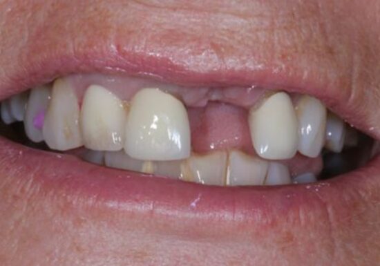 Before - The Houston Group