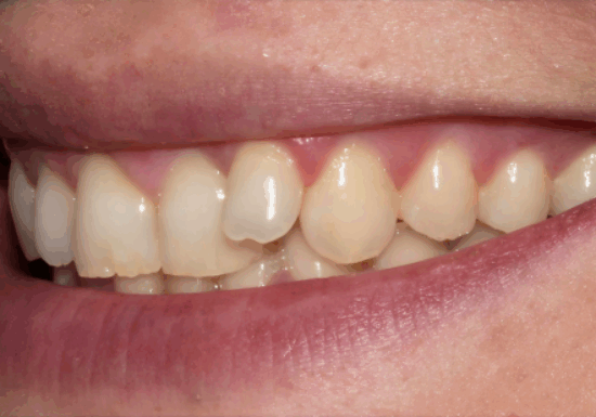 Before - The Houston Group