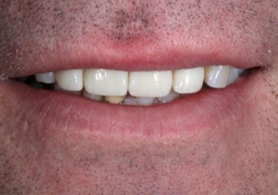 After -The Houston Group