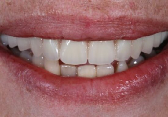 After -The Houston Group