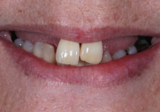 Before - The Houston Group