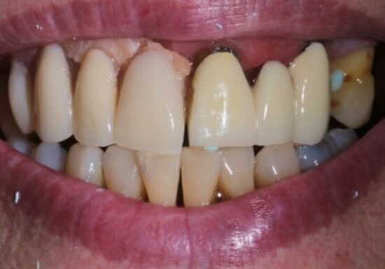 Before - The Houston Group